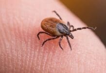 Tick Bites: Prevention, Removal, and Seeking Treatment Image(1)